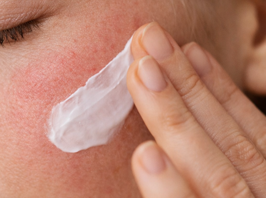 Pourquoi ma peau réagit à tout ?